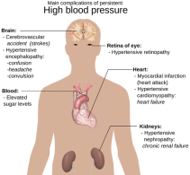 3 Tips to Control Hypertension 